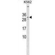 Potassium Voltage-Gated Channel Subfamily E Member 4 (KCNE4) Antibody