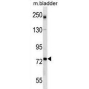 Gamma-Glutamylcysteine Synthetase (GCLC) Antibody