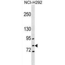 Gamma-Glutamylcysteine Synthetase (GCLC) Antibody