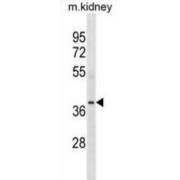 POC1 Centriolar Protein Homolog A (POC1A) Antibody