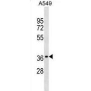 Olfactory Receptor 2W1 (OR2W1) Antibody