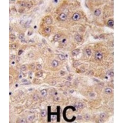 UV Radiation Resistance-Associated Gene Protein (UVRAG) Antibody