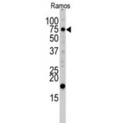 UV Radiation Resistance-Associated Gene Protein (UVRAG) Antibody