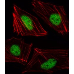 T-Box Protein 15 (TBX15) Antibody