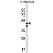 Sorting Nexin 8 (SNX8) Antibody