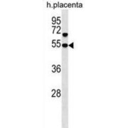 Sorting Nexin Family Member 30 (SNX30) Antibody