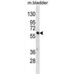 Sorting Nexin Family Member 30 (SNX30) Antibody