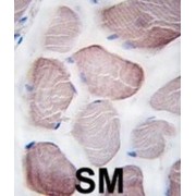 Phosphatidylinositol 3-Kinase Catalytic Subunit Type 3 (PI3KC3) Antibody