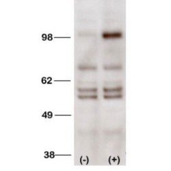 Phosphatidylinositol 3-Kinase Catalytic Subunit Type 3 (PI3KC3) Antibody