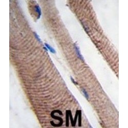 Phosphatidylinositol 3-Kinase Catalytic Subunit Type 3 (PI3KC3) Antibody