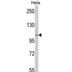 Phosphatidylinositol 3-Kinase Catalytic Subunit Type 3 (PI3KC3) Antibody