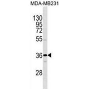 Olfactory Receptor 1I1 (OR1I1) Antibody