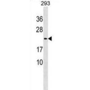 Lysozyme-Like Protein 1 (LYZL1) Antibody