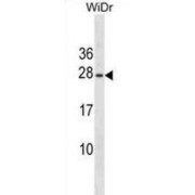 Erythropoietin (EPO) Antibody