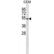 Beta-1,4-Galactosyltransferase 4 (B4GALT4) Antibody