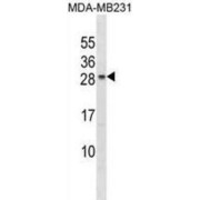 Charged Multivesicular Body Protein 5 (CHMP5) Antibody