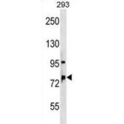 Oxysterol Binding Protein Like 11 (OSBPL11) Antibody