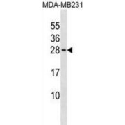 Peptidyl-Prolyl Cis-Trans Isomerase NIMA-Interacting 4 (PIN4) Antibody