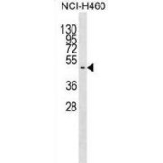 Neuroendocrine Secretory Protein 55 (GNAS) Antibody