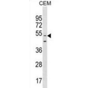 Golgin Subfamily A Member 6-Like 9 Protein (GOLGA6L9) Antibody