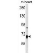 HBS1-Like Protein (HBS1L) Antibody