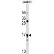 Interleukin 17 Receptor C (IL17RC) Antibody