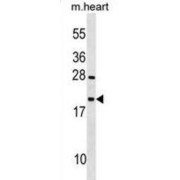 Testis Expressed 12 (TEX12) Antibody