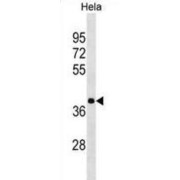 Heterogeneous Nuclear Ribonucleoprotein A3 (HNRNPA3) Antibody