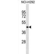 Hepatocellular Carcinoma Protein HHCM (HHCM) Antibody