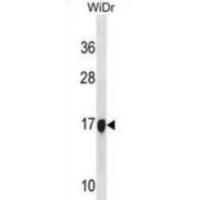 Histone H2B Type F-S (H2BC12L) Antibody