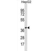 Olfactory Receptor Family 4 Subfamily X Member 1 (gene/pseudogene) (OR4X1) Antibody