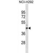 Metallophosphoesterase 1 (MPPE1) Antibody