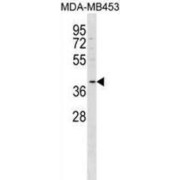 Free Fatty Acid Receptor 2 (FFAR2) Antibody