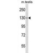 TBC1 Domain Family Member 2 (TBC1D2) Antibody