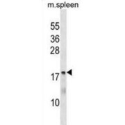 Methenyltetrahydrofolate Synthetase (MTHFS) Antibody