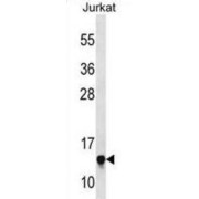 Ribosomal Protein S23 (RPS23) Antibody