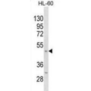 Mouse Kcnj11 Antibody