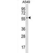 Endothelial Cell Adhesion Molecule (ESAM) Antibody