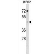 Beta-1,3-Galactosyl-O-Glycosyl-Glycoprotein Beta-1,6-N-Acetylglucosaminyltransferase 7 (GCNT7) Antibody