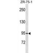 WB analysis of ZR-75-1 cell line lysates.