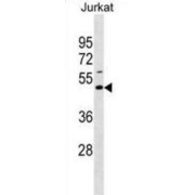 Ell-Associated Factor 1 (EAF1) Antibody