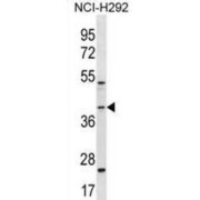 GIPC PDZ Domain Containing Family, Member 2 (GIPC2) Antibody