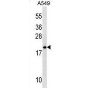 Mitochondrial Ribosomal Protein L40 (MRPL40) Antibody