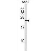 Myosin Light Chain 6B, Alkali, Smooth Muscle And Non Muscle (MYL6B) Antibody