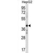 Zinc Finger Protein AEBP2 (AEBP2) Antibody