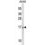 Epithelial Membrane Protein 3 (EMP3) Antibody