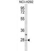 Chymotrypsin Like Protein (CTRL) Antibody