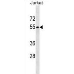 Septin 6 (SEPTIN6) Antibody