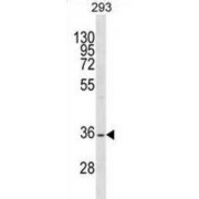Single-Stranded DNA-Binding Protein 2 (SSBP2) Antibody