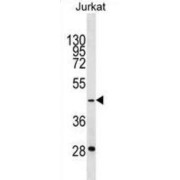 General Transcription Factor IIIA (GTF3A) Antibody